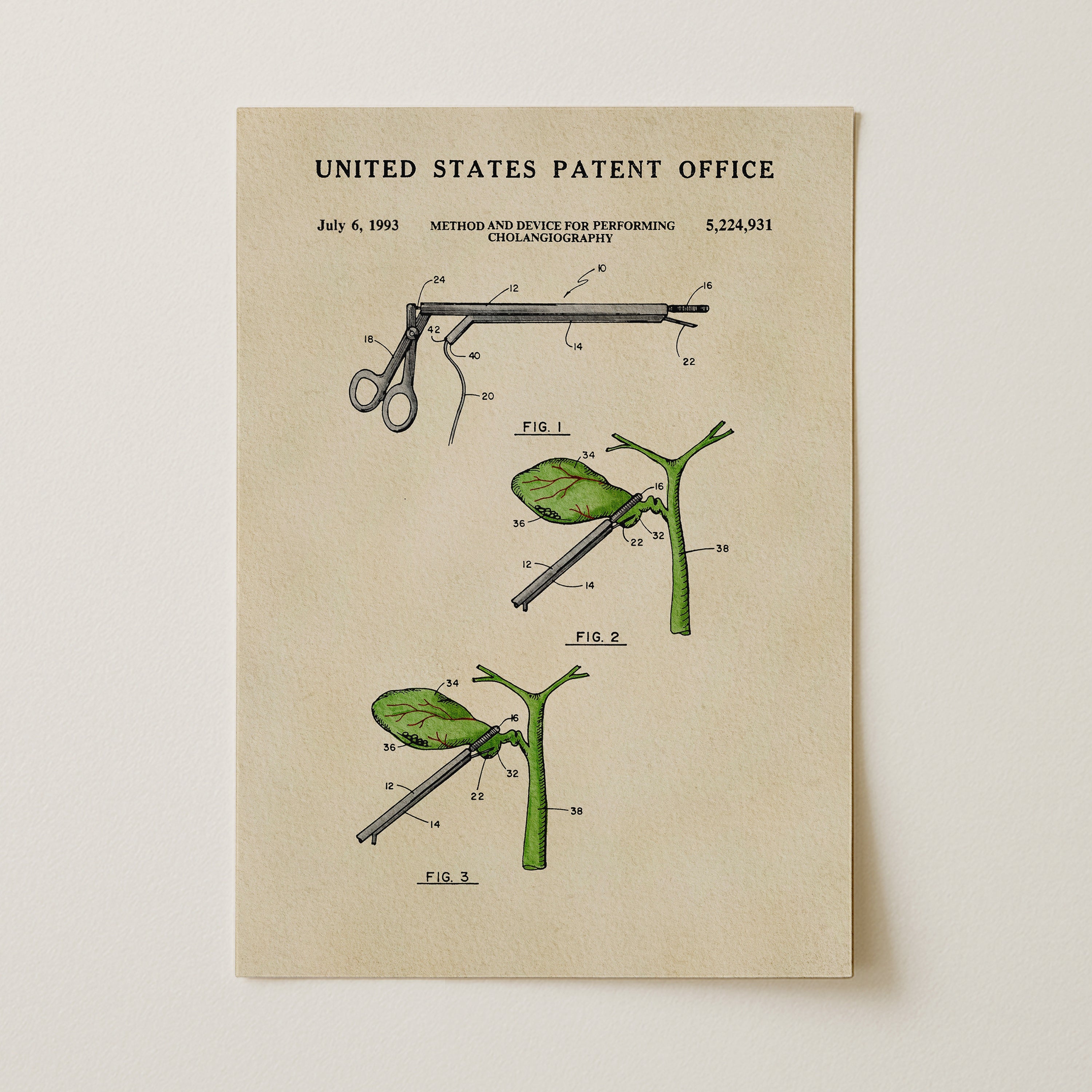 The image is a patent drawing from the United States Patent Office, depicting a method and device for performing cholecystoscopy.