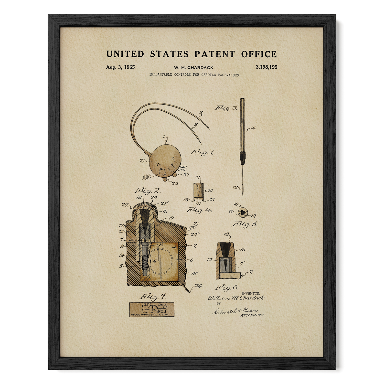 Cardiac Pacemaker Controls (1965)