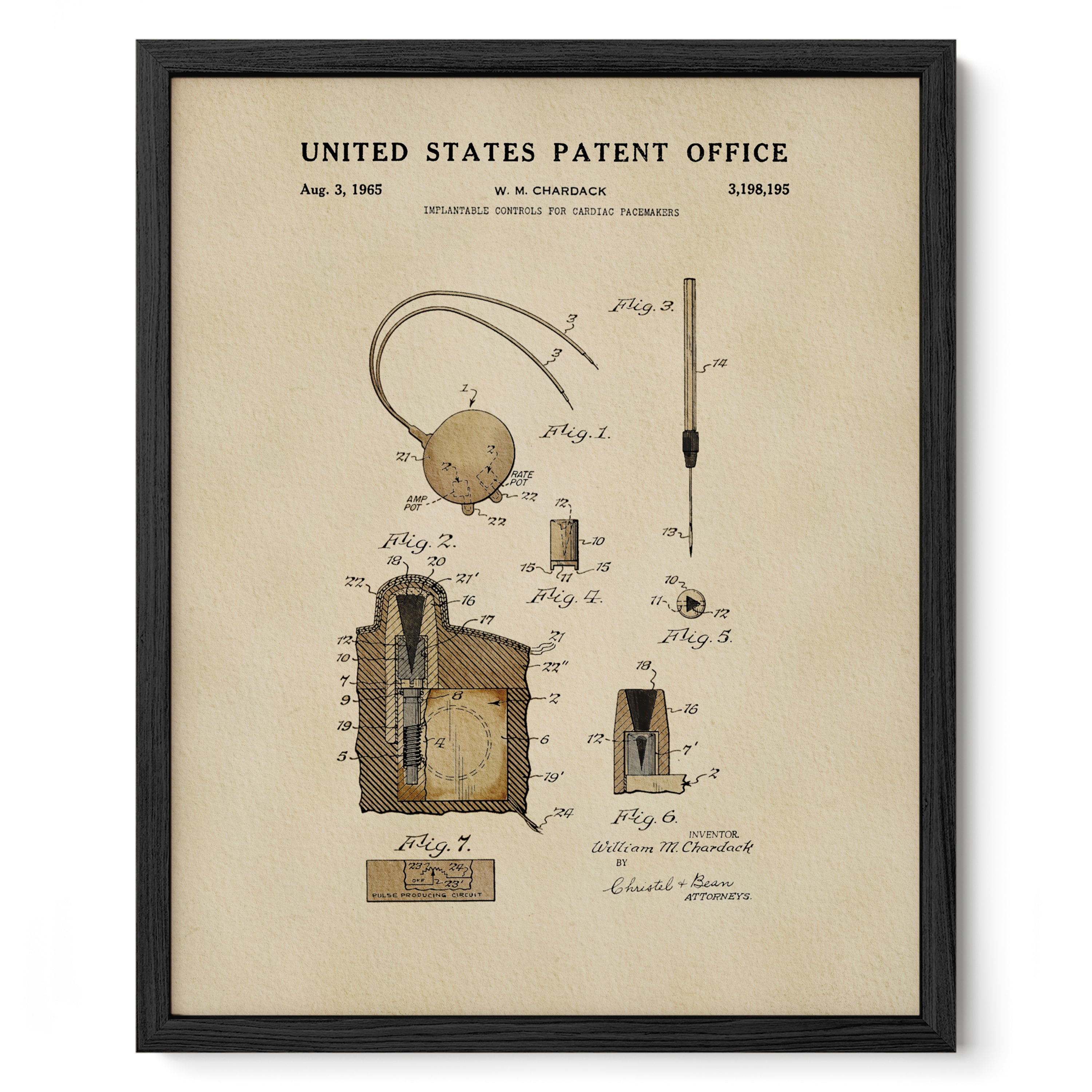 Cardiac Pacemaker Controls (1965)