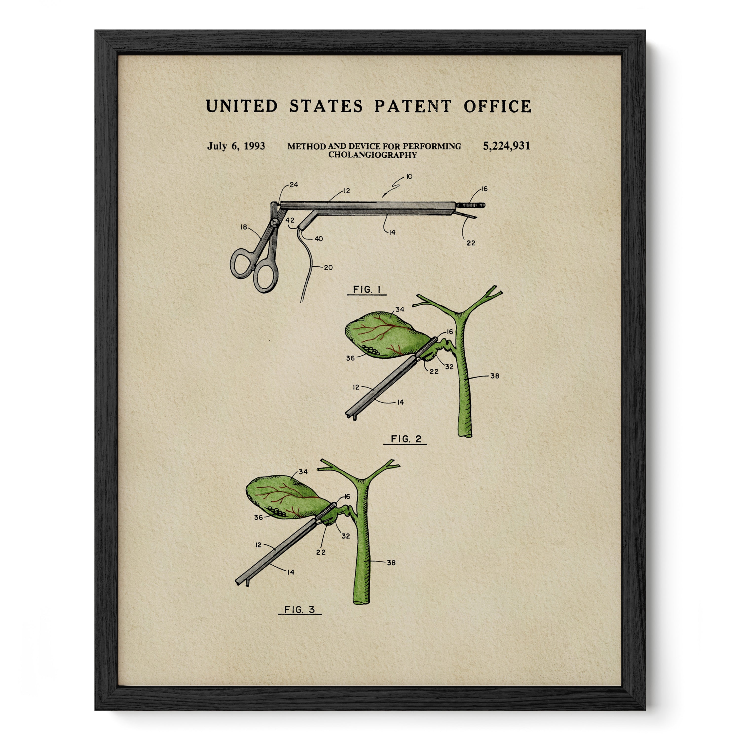 The image is a framed patent illustration depicting a medical device used for performing a procedure.