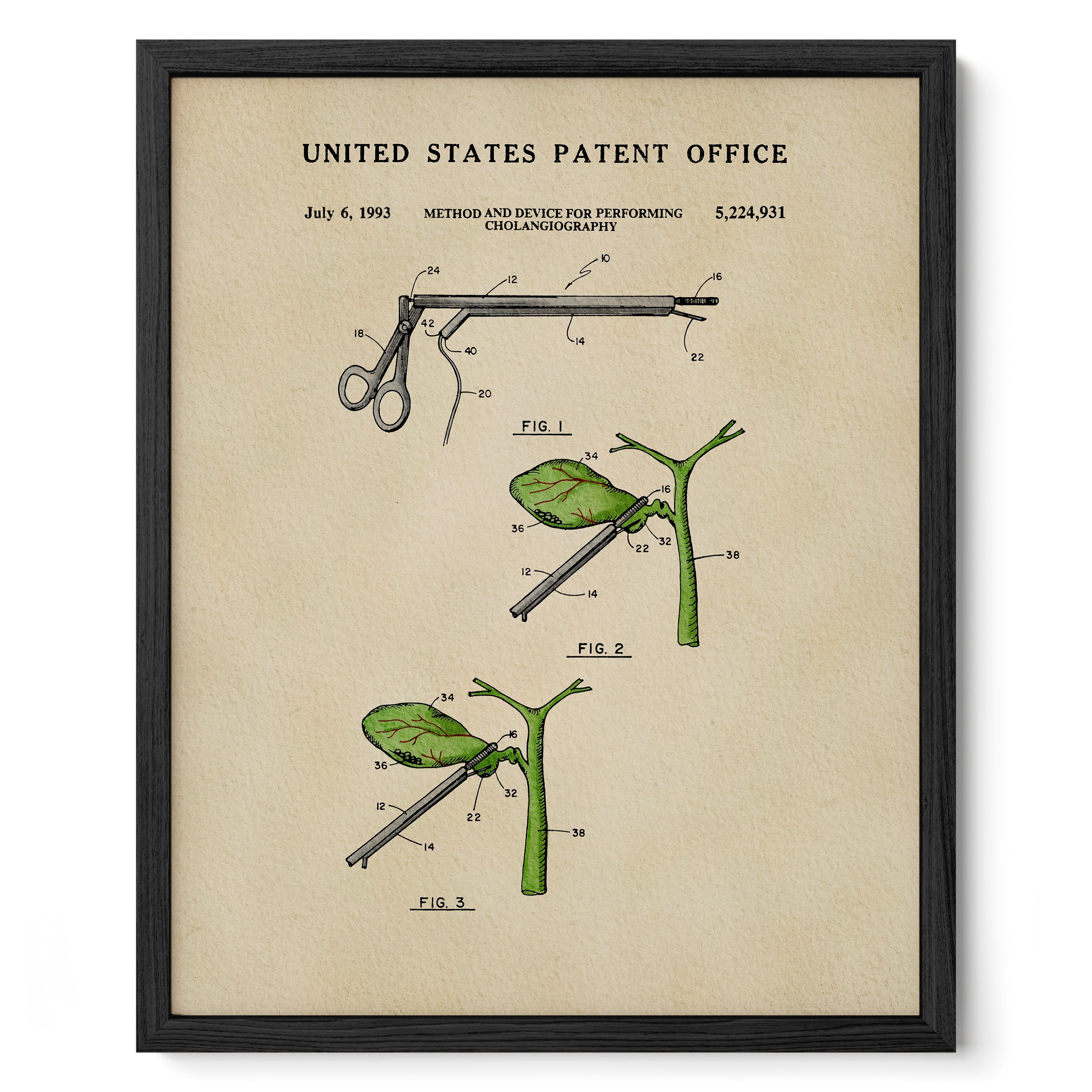 The image is a framed patent drawing depicting a medical device used for performing cholecystography, a procedure involving the examination of the gallbladder and liver.