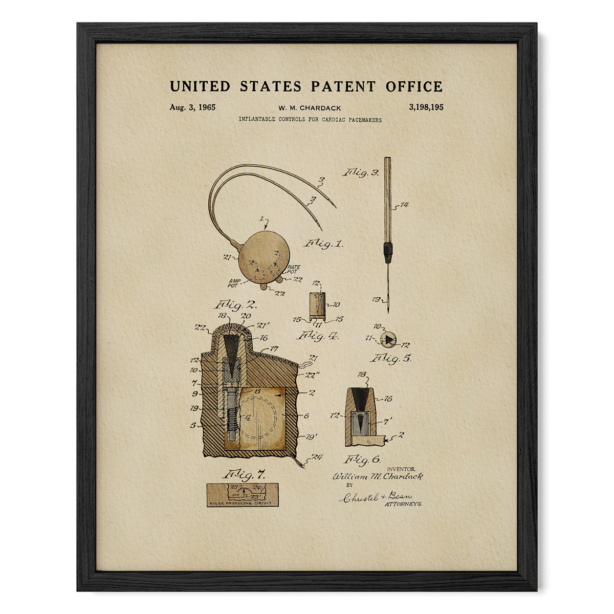 Cardiac Pacemaker Controls (1965) patent art print