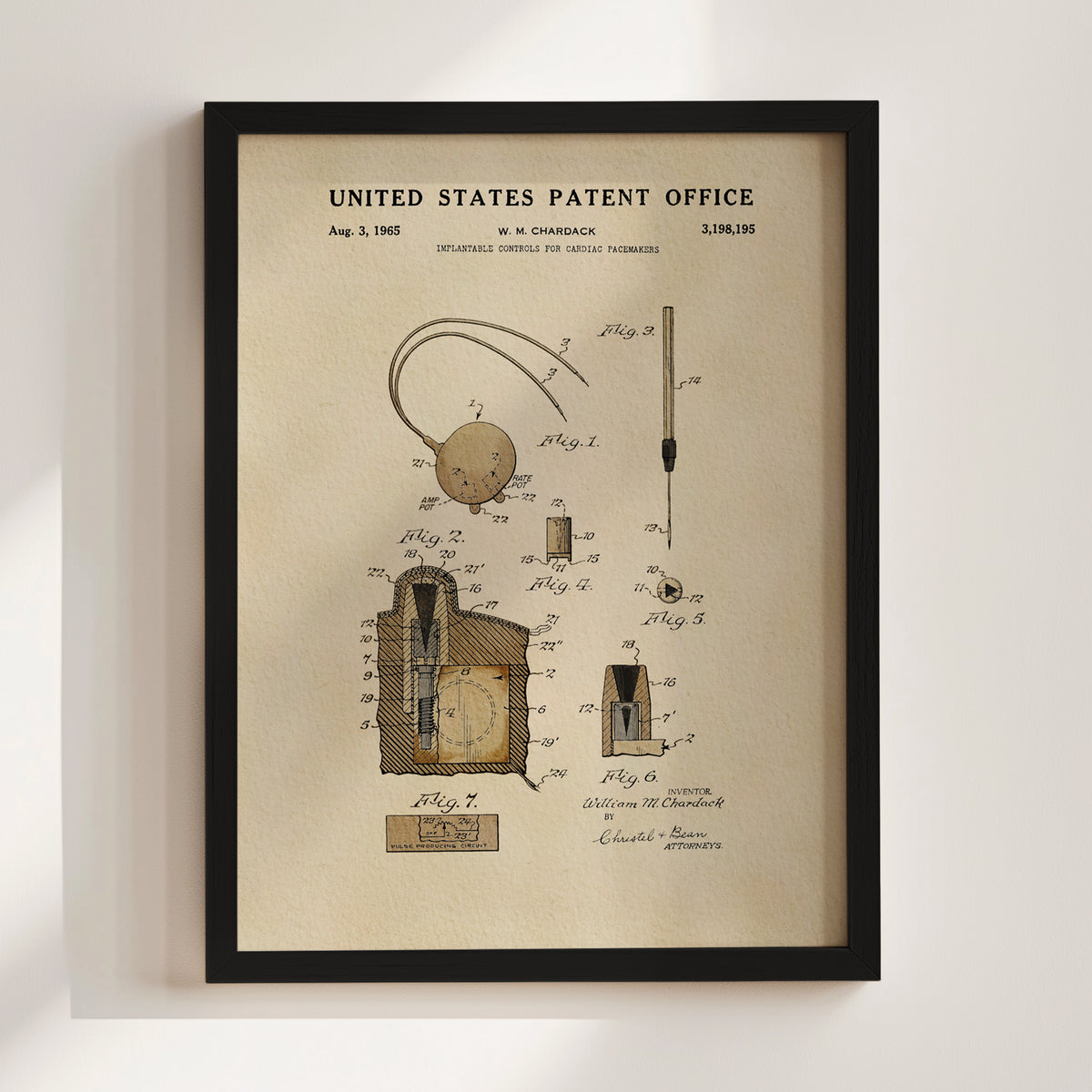 Cardiac Pacemaker Controls (1965) patent art print