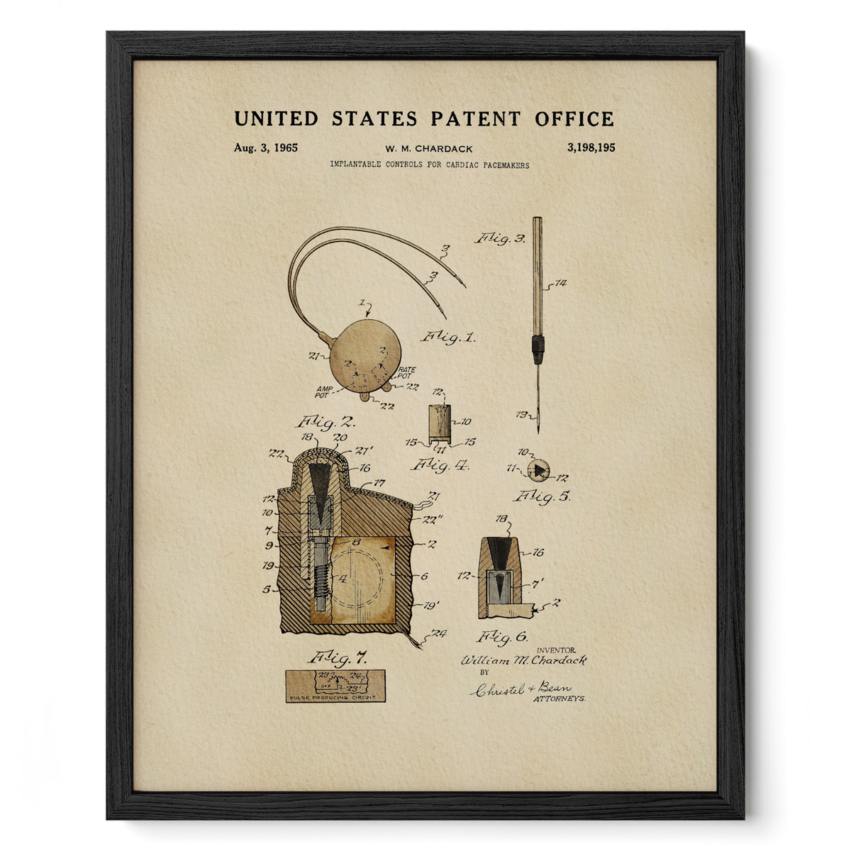 Cardiac Pacemaker Controls (1965) patent art print
