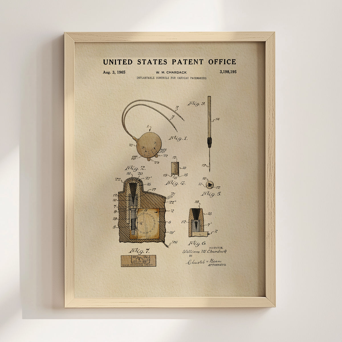Cardiac Pacemaker Controls (1965) patent art print