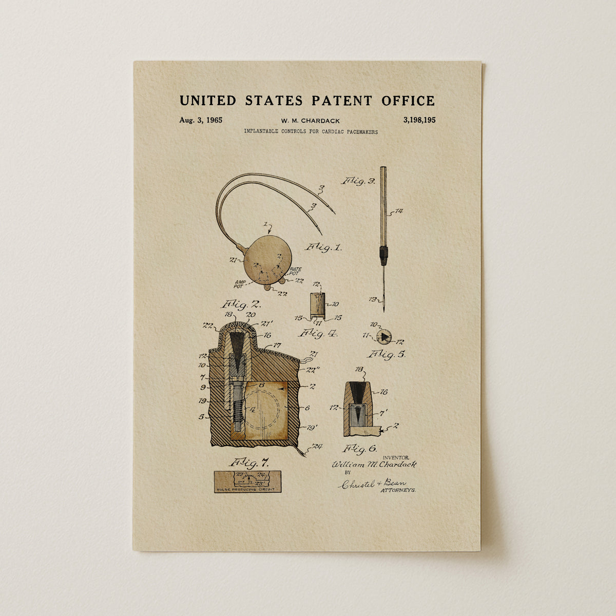 Cardiac Pacemaker Controls (1965) patent art print