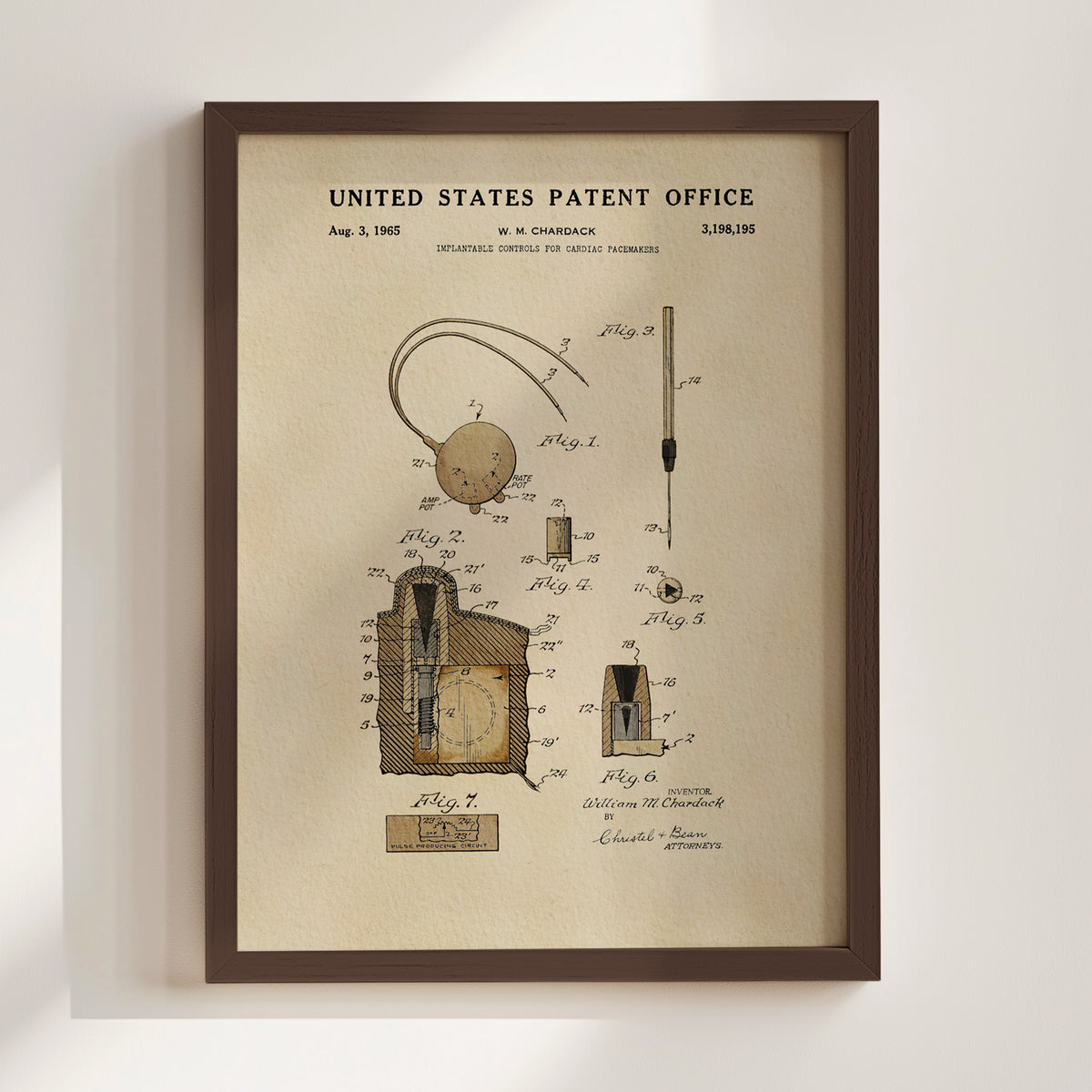 Cardiac Pacemaker Controls (1965) patent art print