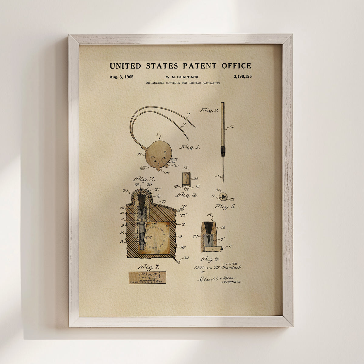 Cardiac Pacemaker Controls (1965) patent art print
