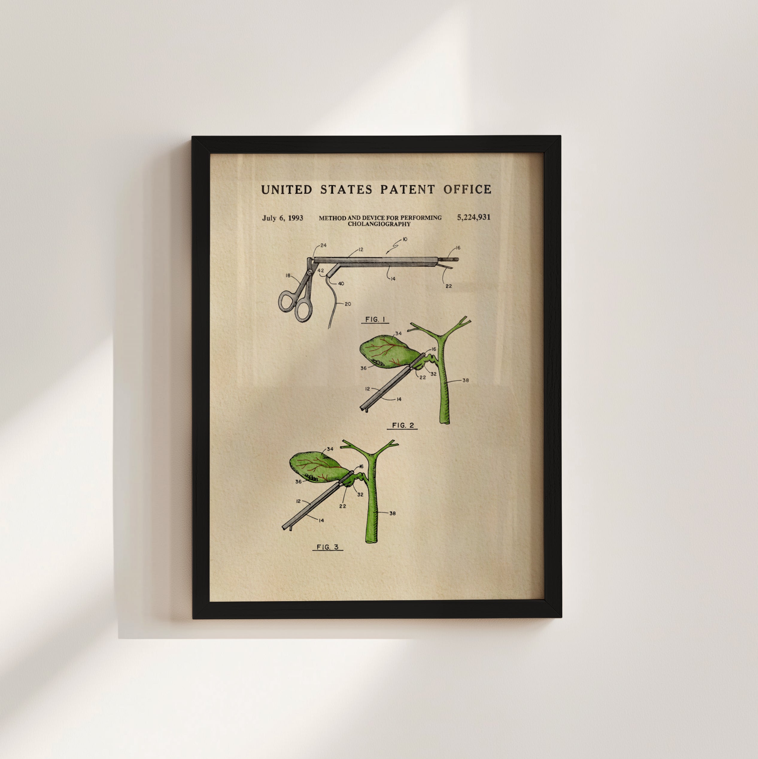 The image is a framed patent drawing depicting a medical device, specifically a stent, with various diagrams and illustrations.