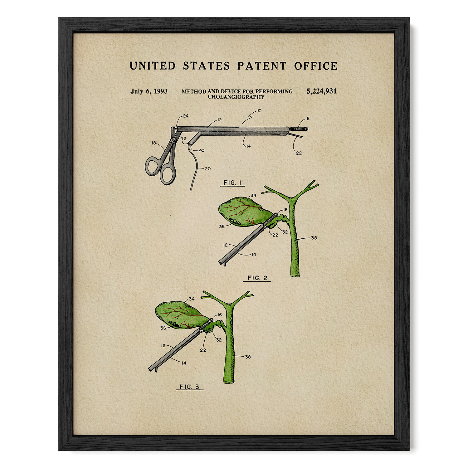 The image is a framed patent drawing depicting a medical device used for performing cholecystography, a procedure for measuring the size of the gallbladder.