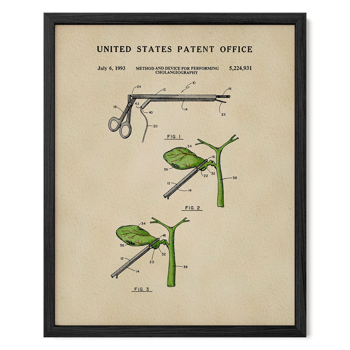 The image is a framed patent drawing depicting a medical device used for performing cholecystography, a procedure for measuring the size of the gallbladder.