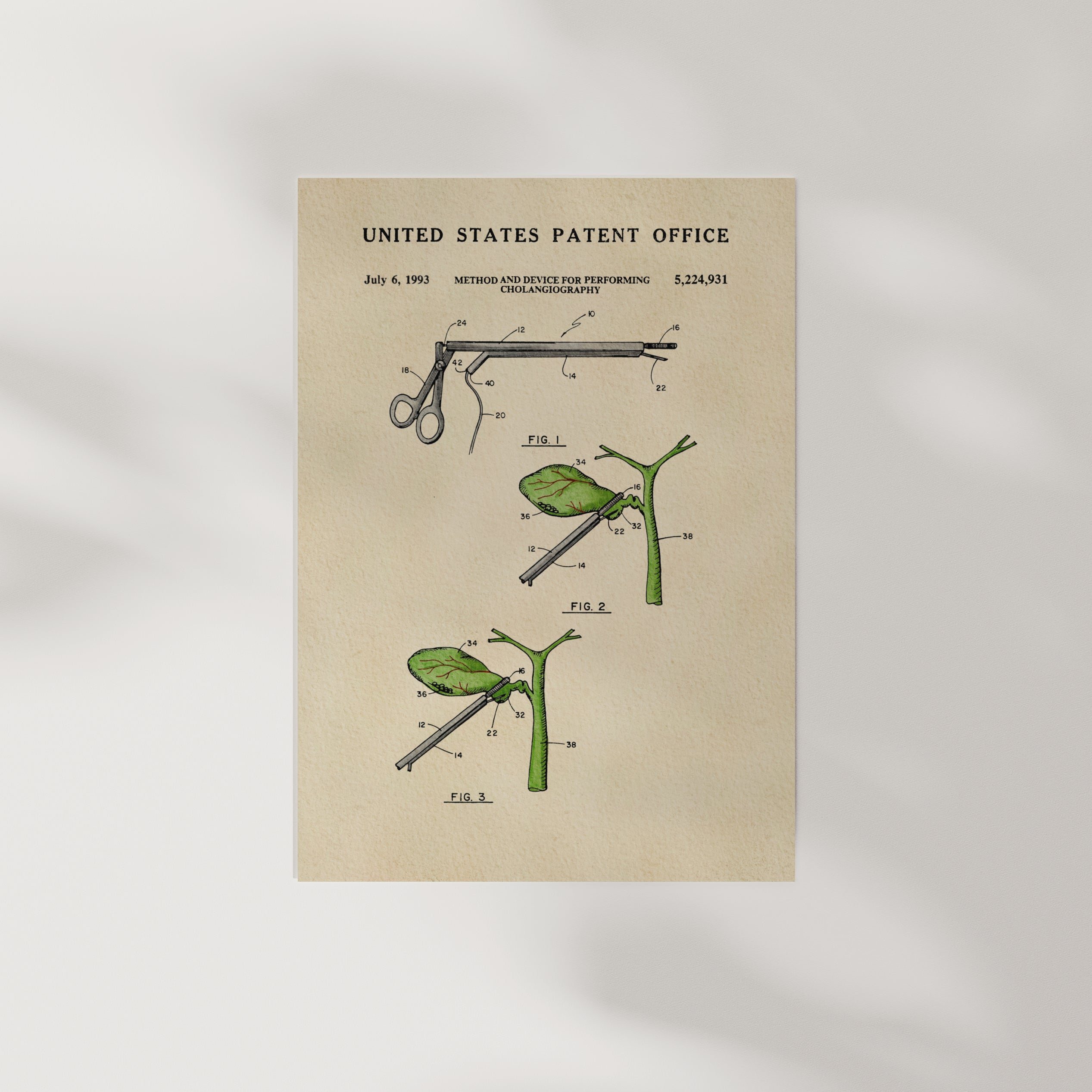 The image is a vintage United States patent office patent drawing depicting a method and device for performing cholecystography.